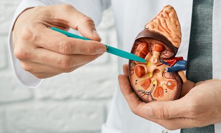 Kanker Ginjal, Mengapa Kemoterapi Hampir Tidak Berperan?