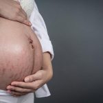 Selulit Atau Stretch Mark Sering Terjadi Pada Ibu Hamil