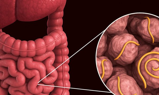 Cacingan Dapat Terjadi Melalui Makanan Yang Terkontaminasi