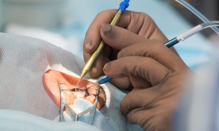 Informasi Rinci Tentang Lasik Mata Yang Wajib Di Pahami