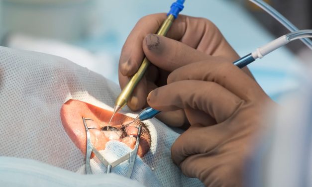 Informasi Rinci Tentang Lasik Mata Yang Wajib Di Pahami